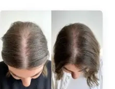 Before and after hair photo from Emily S.'s review