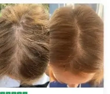Before and after hair photo from Rachel B.'s review